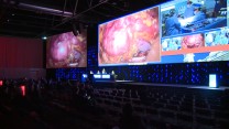 Learning from the Masters: Live Surgery at EAU 2015